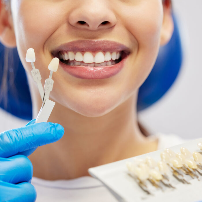 dentangora-zirkonyum-kaplama-acil-dis-hekimi-ankara
